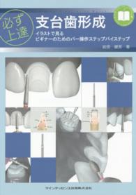 必ず上達支台歯形成 イラストで見るビギナーのためのバー操作ステップバイステップ