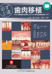 必ず上達歯肉移植 FGG(遊離歯肉移植術)&CTG(結合組織移植術)入門
