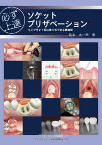 必ず上達ソケットプリザベーション インプラント初心者でもできる骨造成