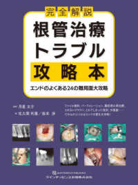 完全解説根管治療トラブル攻略本 エンドのよくある24の難局面大攻略