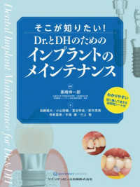 そこが知りたい!Dr.とDHのためのインプラントのメインテナンス