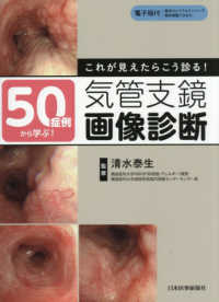 50症例から学ぶ!これが見えたらこう診る!気管支鏡画像診断