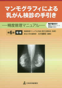 マンモグラフィによる乳がん検診の手引き 精度管理マニュアル