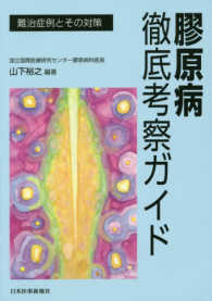 膠原病徹底考察ガイド 難治症例とその対策