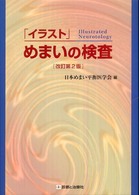 「イラスト」めまいの検査