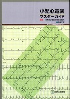 小児心電図・マスターガイド