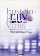 EBウイルス