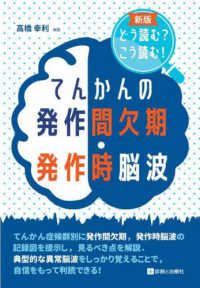 てんかんの発作間欠期・発作時脳波 どう読む?こう読む!