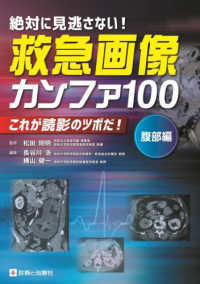 絶対に見逃さない!救急画像カンファ100 腹部編 これが読影のツボだ!