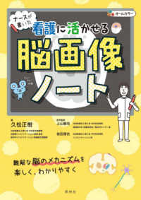 ナースが書いた看護に活かせる脳画像ノート