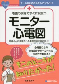 看護の現場ですぐに役立つモニター心電図