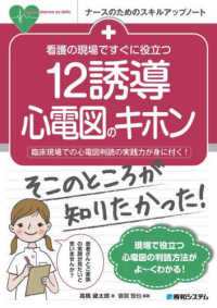 看護の現場ですぐに役立つ12誘導心電図のキホン 臨床現場での心電図判読の実践力が身に付く! ナースのためのスキルアップノート