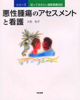 悪性腫瘍のｱｾｽﾒﾝﾄと看護 ｼﾘｰｽﾞ知っておきたい最新看護技術