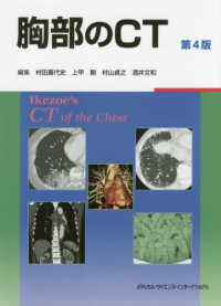 胸部のCT