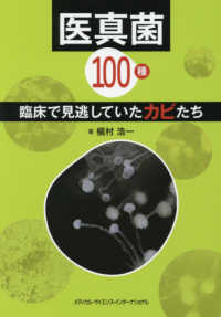 医真菌100種 臨床で見逃していたカビたち