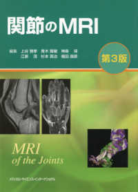 関節のMRI