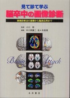 見て診て学ぶ脳卒中の画像診断 画像診断法の基礎から臨床応用まで