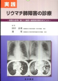 実践リウマチ肺障害の診療 実際の症例に基づく胸部X線読影診断のポイント