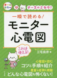 一瞬で読める!ﾓﾆﾀｰ心電図 ﾅｰｽのﾐｶﾀ!