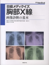 胸部X線 画像診断の基本 日経メディクイズ