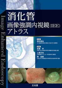 消化管画像強調内視鏡(IEE)アトラス : electronic bk