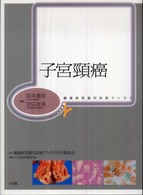 子宮頸癌
