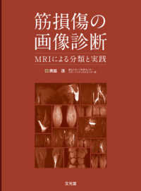 筋損傷の画像診断 MRIによる分類と実践