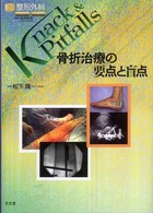 骨折治療の要点と盲点