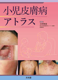 小児皮膚病ｱﾄﾗｽ