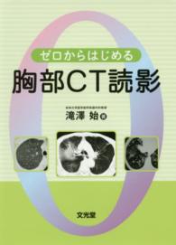 ゼロからはじめる胸部CT読影