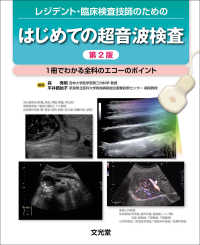 ﾚｼﾞﾃﾞﾝﾄ･臨床検査技師のためのはじめての超音波検査 1冊でわかる全科のｴｺｰのﾎﾟｲﾝﾄ
