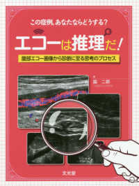 エコーは推理だ! 腹部エコー画像から診断に至る思考のプロセス  この症例,あなたならどうする?