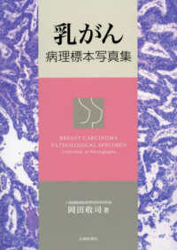 乳がん病理標本写真集 Breast carcinoma pathological specimen  collection of photographs