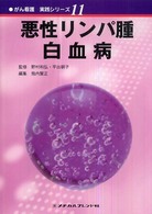 悪性リンパ腫・白血病 がん看護実践シリーズ