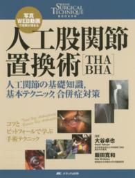 人工股関節置換術「THA・BHA」 人工関節の基礎知識,基本テクニック,合併症対策  写真・WEB動画で理解が深まる 整形外科Surgical technique books