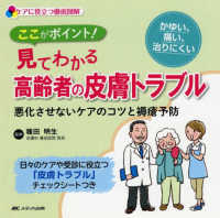 ここがポイント!見てわかる高齢者の皮膚トラブル 悪化させないケアのコツと褥瘡予防 ケアに役立つ徹底図解