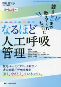 なるほど人工呼吸管理