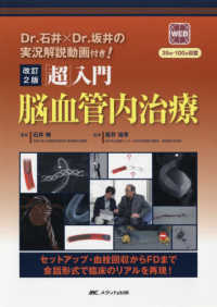 「超」入門脳血管内治療 : electronic bk 改訂2版