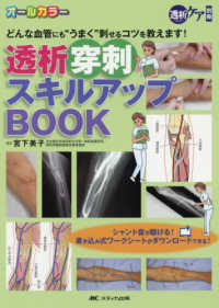 透析穿刺スキルアップBOOK どんな血管にも"うまく"刺せるコツを教えます! 透析ケア