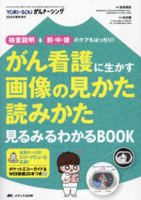 がん看護に生かす画像の見かた読みかた見るみるわかるBOOK 検査説明&前･中･後のｹｱもばっちり! YORi‐SOUがんﾅｰｼﾝｸﾞ ; 2024年春季増刊(通巻88号)