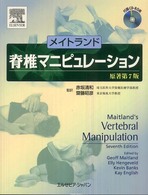 メイトランド脊椎マニピュレーション