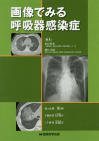 画像でみる呼吸器感染症