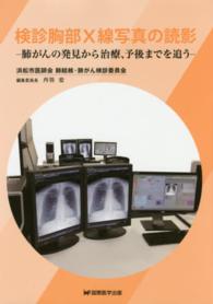 検診胸部X線写真の読影