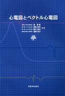 心電図とベクトル心電図
