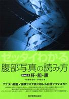 肝・胆・膵 ゼッタイわかる腹部写真の読み方