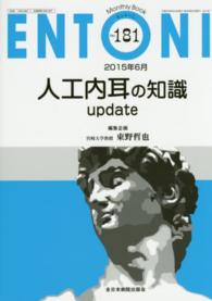 人工内耳の知識update