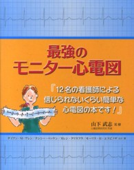 最強のモニター心電図