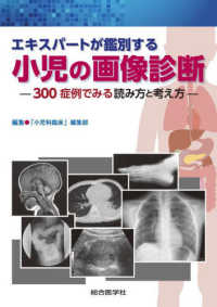 エキスパートが鑑別する小児の画像診断 : electronic bk 300症例でみる読み方と考え方