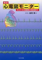 心電図ﾓﾆﾀｰ ﾓﾆﾀｰから各種検査と緊急処置まで