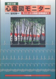 心電図モニター モニターから関連の各種検査まで